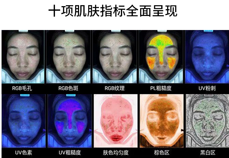 皮肤检测仪的十种检测方法